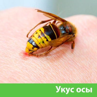 Профессиональное уничтожение ос и шершней в Чебоксарах
