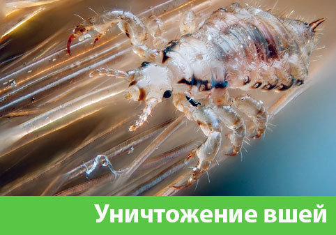 Уничтожение вшей в городе Чебоксары